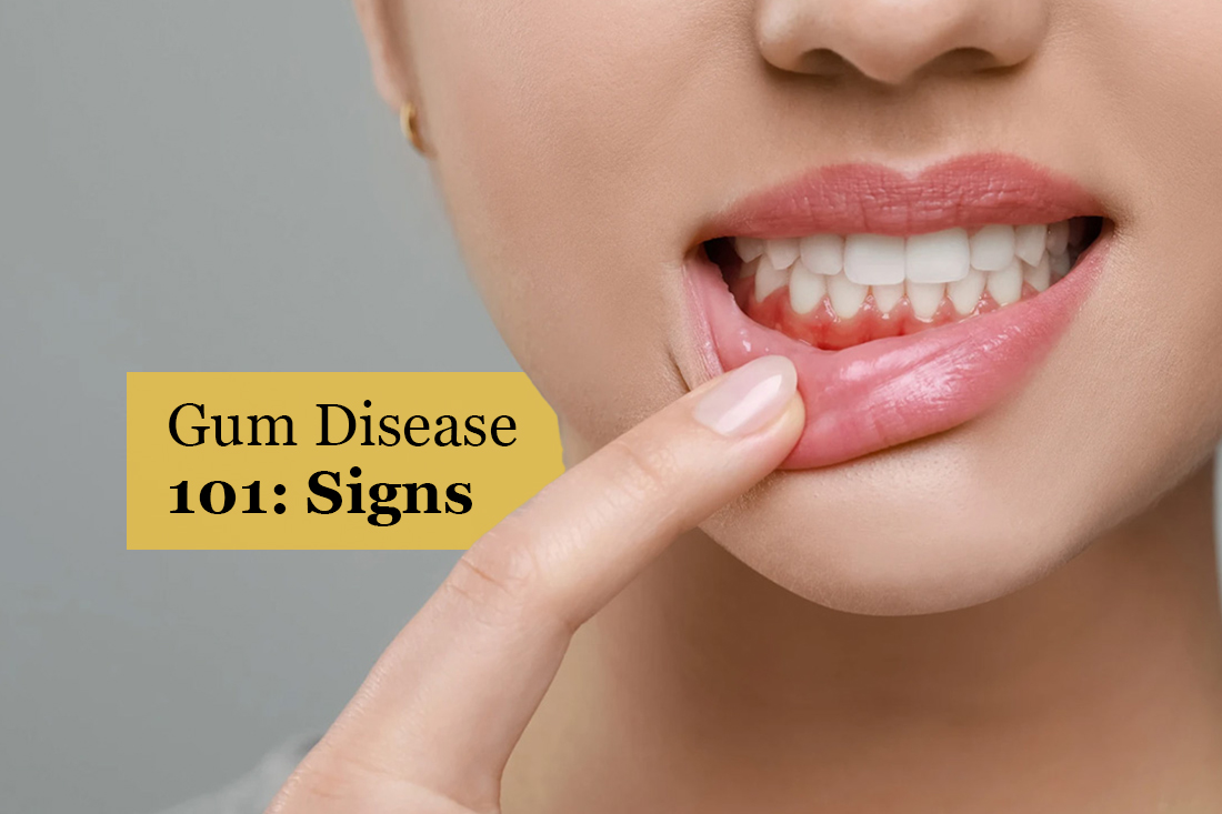 Woman pointing to her gum line to show irritation