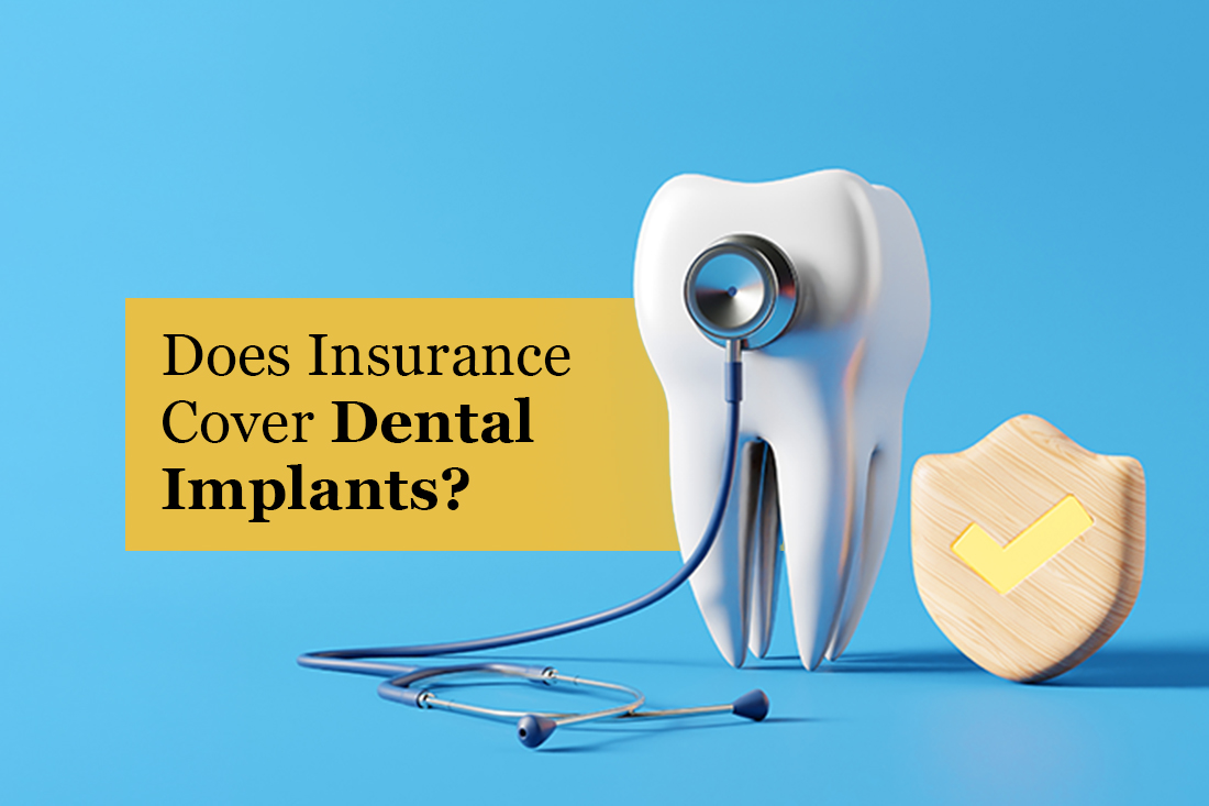 Model tooth with a stethoscope, representing dental insurance cover