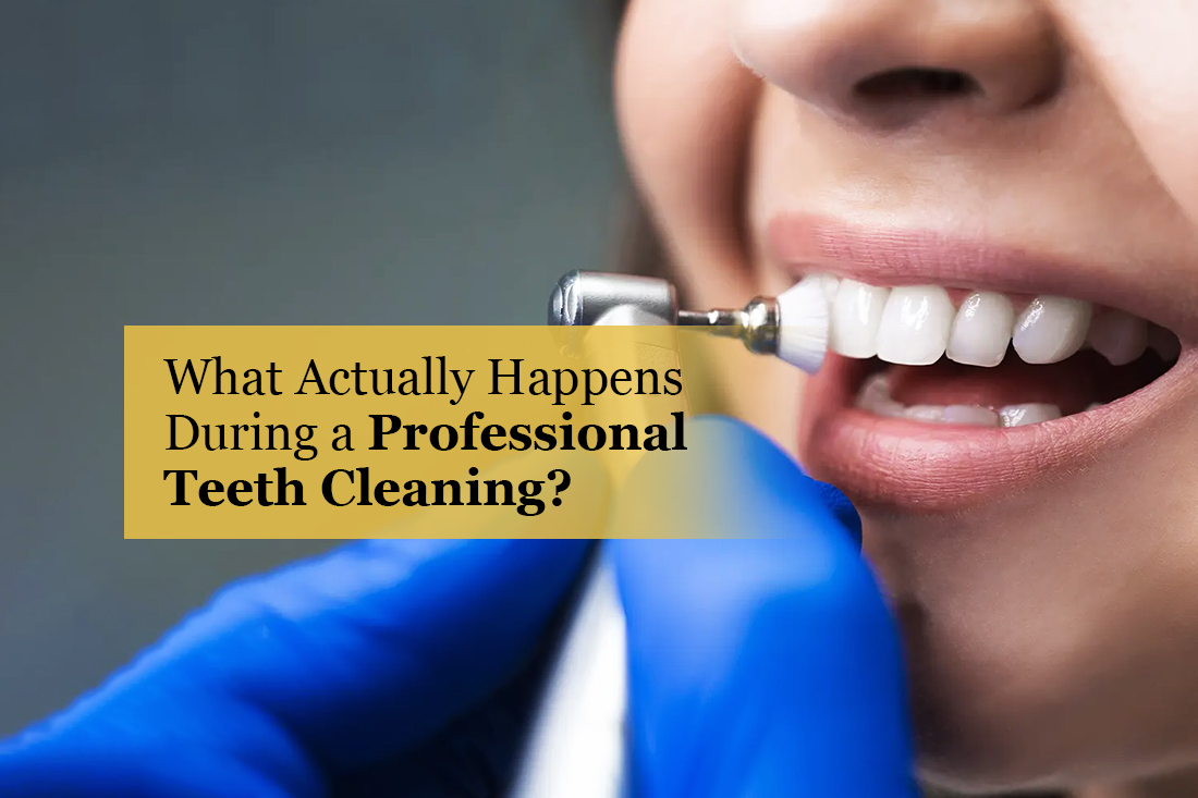 Professional teeth cleaning at Real Dentistry in Fullerton