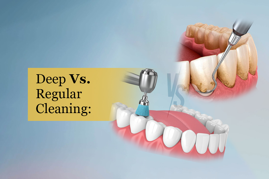 Gum health assessment before a deep cleaning at Real Dentistry