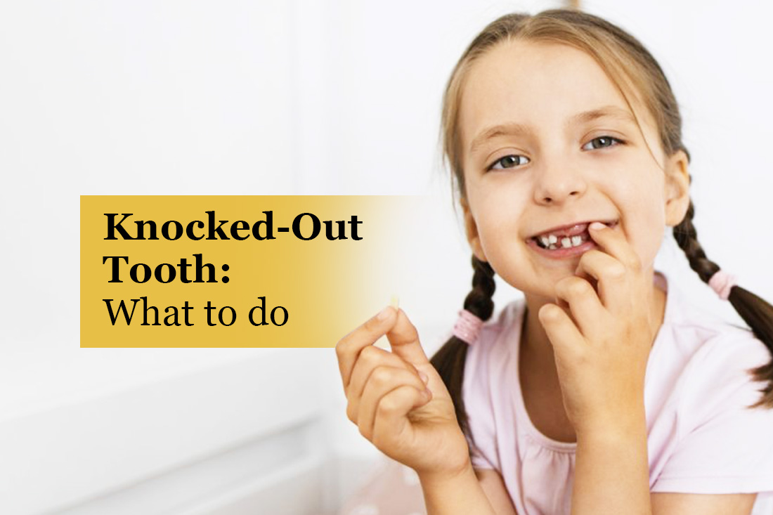 Knocked-Out Tooth, What to Do: young girl holding a tooth that has come out
