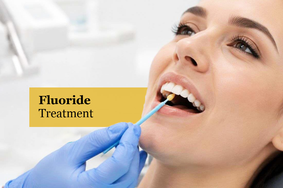 Image placeholder: Fluoride treatment