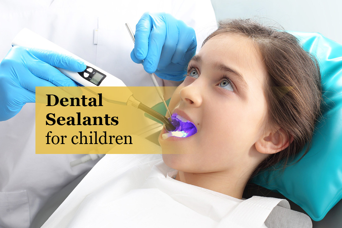 Image placeholder: Dental sealants