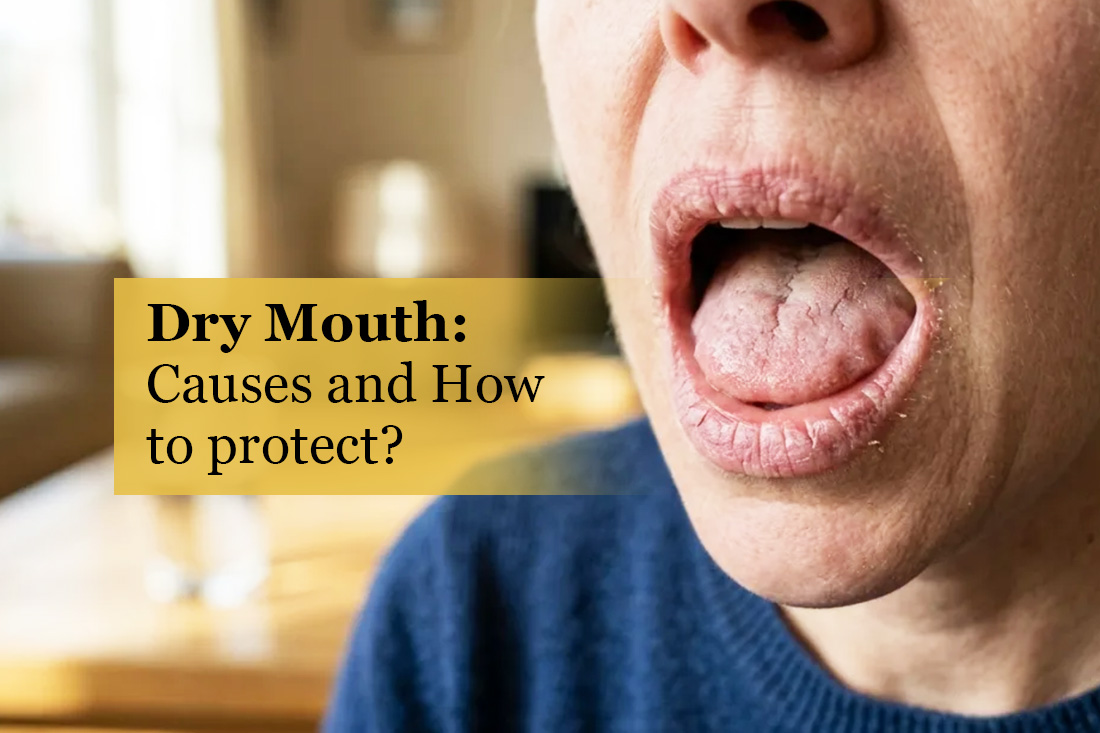Image placeholder: Dry mouth care