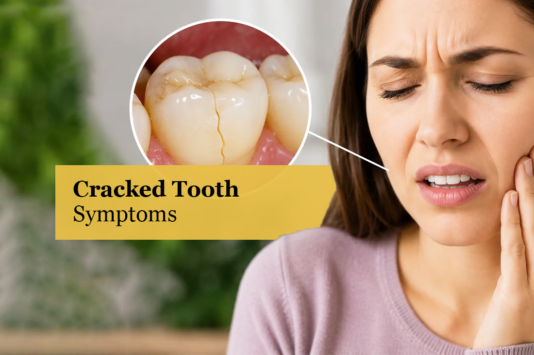 Image placeholder: Cracked tooth assessment