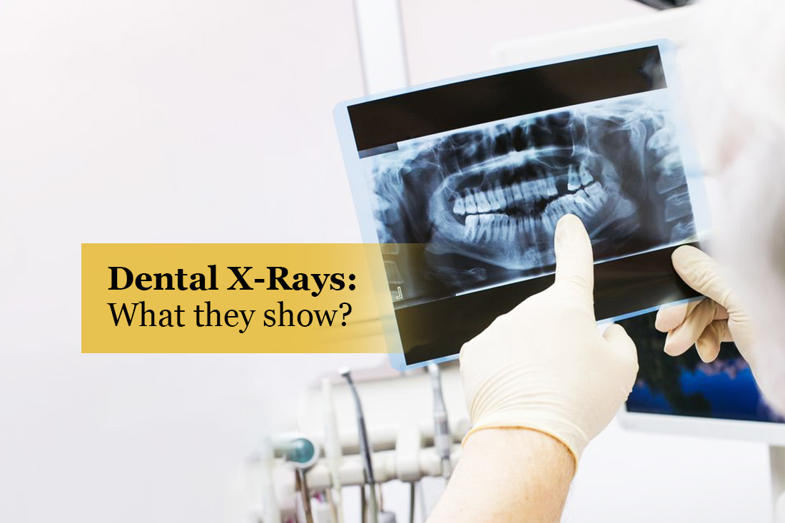 Image placeholder: Dental X-rays