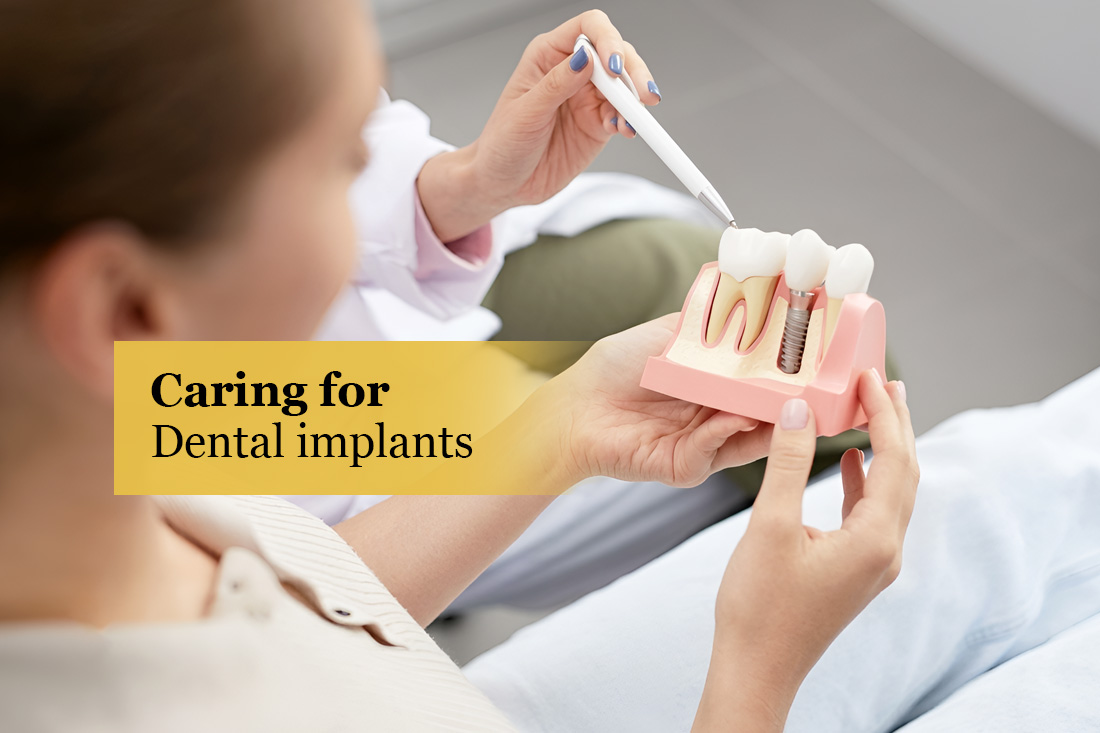Image placeholder: Dental implant care