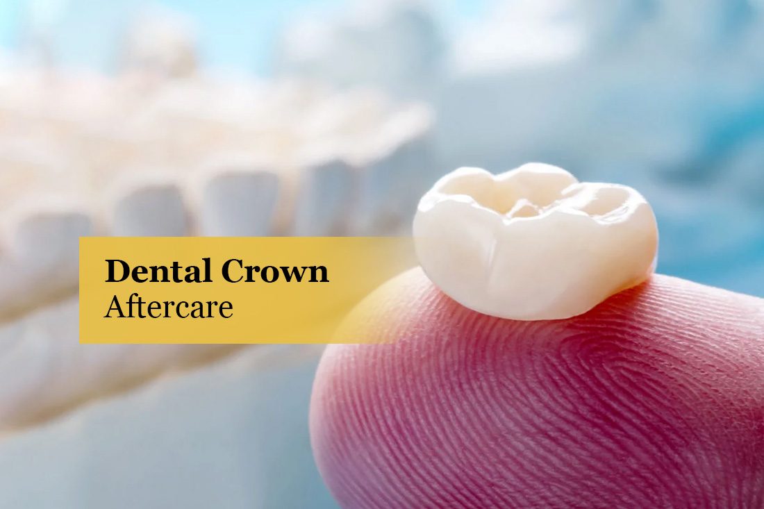 Image placeholder: Dental crown aftercare