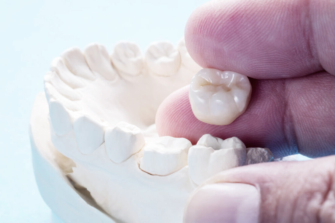 Restorative Dentistry at Real Dentistry in Fullerton, CA