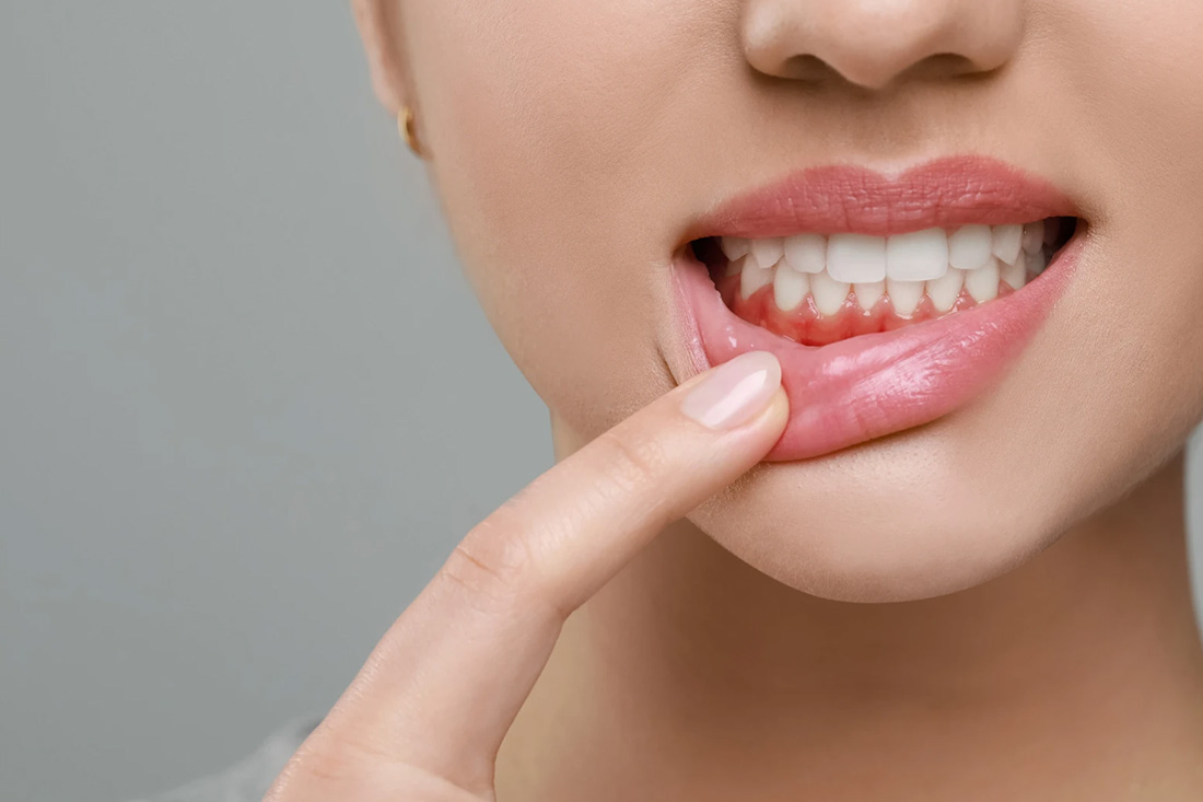 Periodontal Therapy at Real Dentistry in Fullerton, CA
