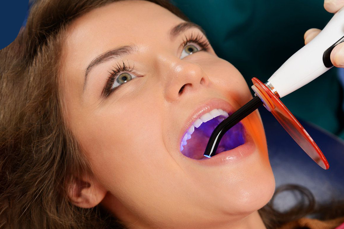 Oral Cancer Screening at Real Dentistry in Fullerton, CA