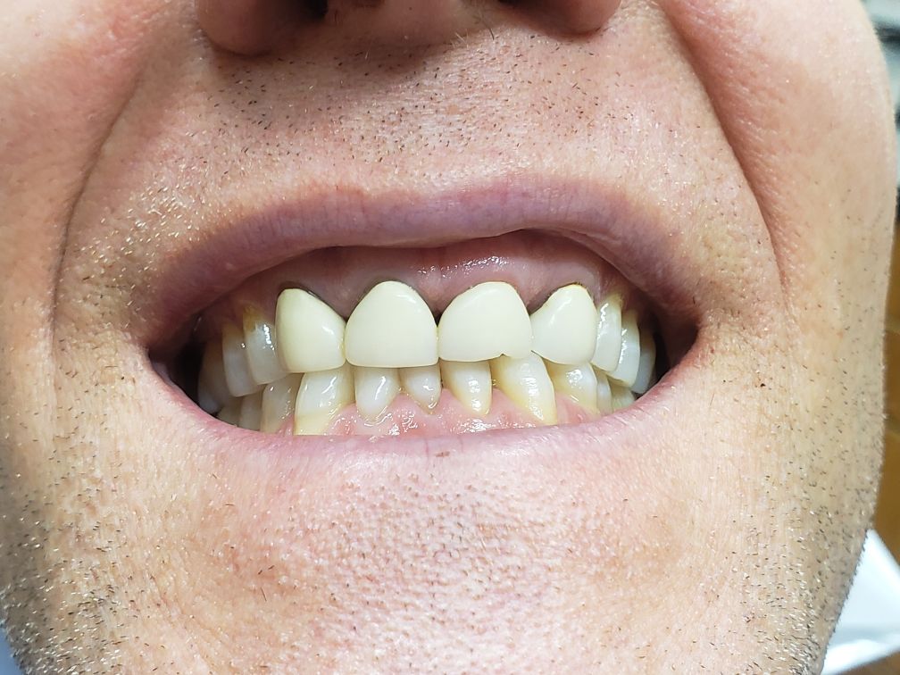 Same Day Treatment at Real Dentistry