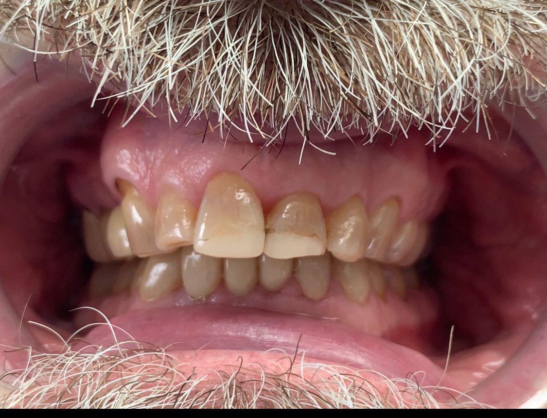 Restorative Dentistry at Real Dentistry