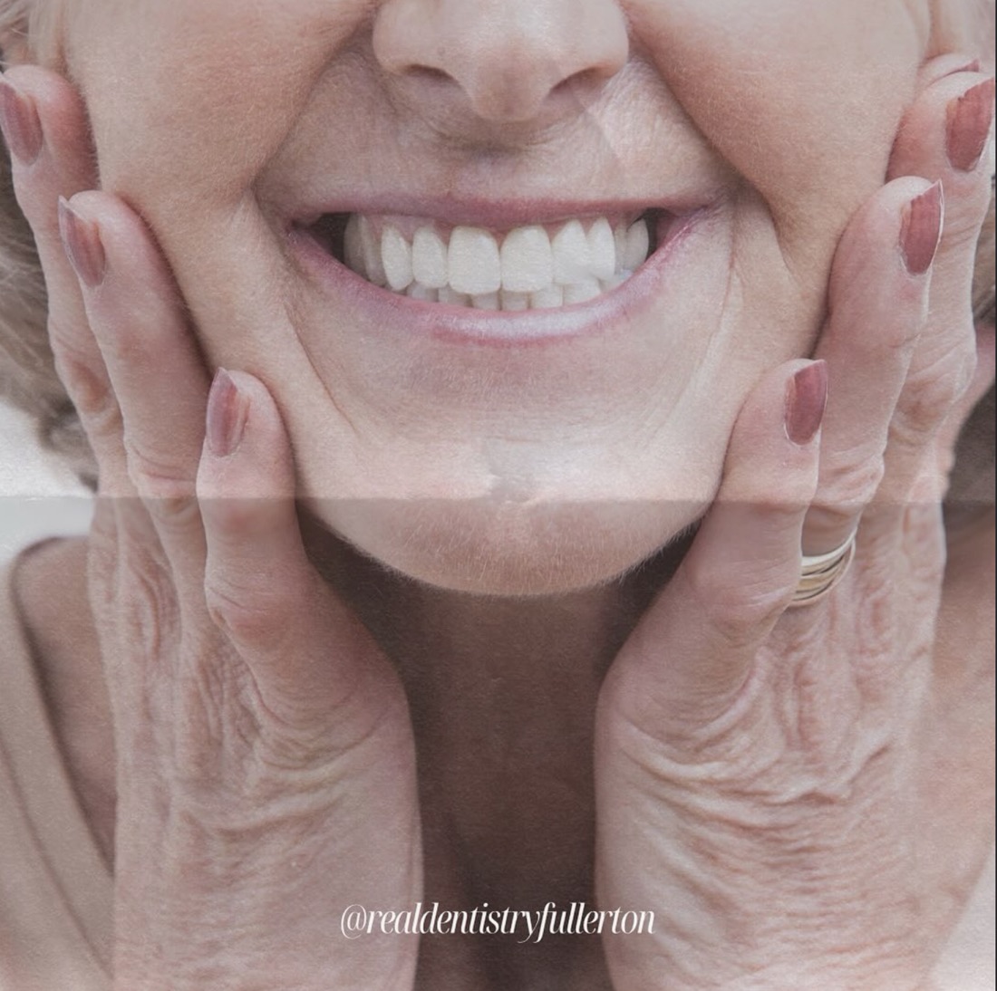 Before and after smile transformation